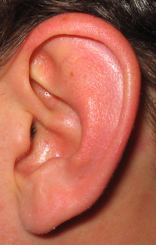 ear-discharge