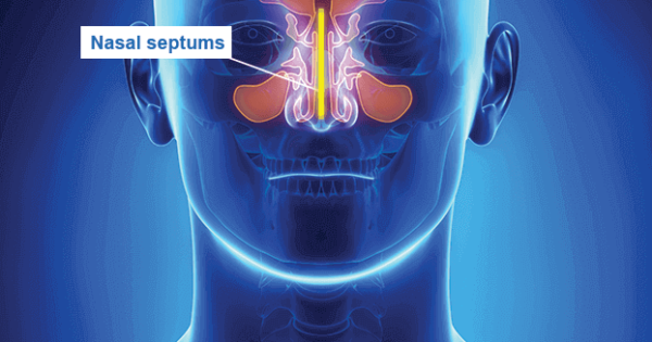 Nasal & Sinus Glossary of Terms | Houston Sinus & Allergy