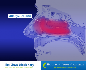 Nasal & Sinus Glossary of Terms | Houston Sinus & Allergy