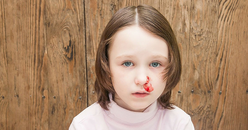 Does Your Child Get Nosebleeds