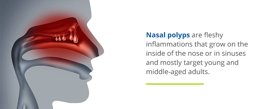 Nasal Polyp Causes Symptoms Treatment Nasal Polyp